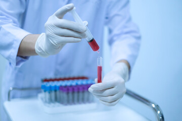medical technician dropping blood sample to test tube in hospital laboratory