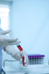 medical technician dropping blood sample to test tube in hospital laboratory