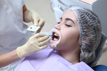 The dentist applies the gel to the patient's teeth before professional dental cleaning. Prevention of caries and gum diseases. Hands in protective gloves.