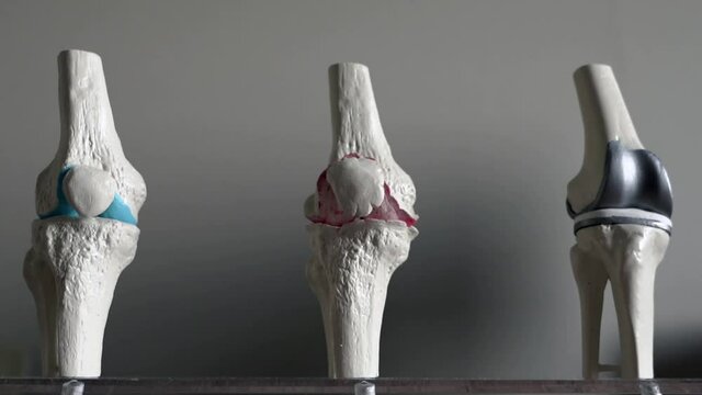 knee joint mockup. 