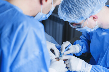 Blepharoplasty plastic surgery operation for modifying the eye region of the face in medical...