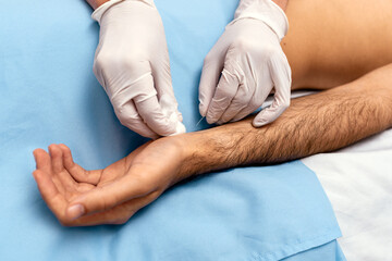 Man Receiving Acupuncture Treatment