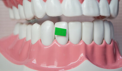 Green vegetables on the below teeth model.Dental care demonstration.Dental care concept.
