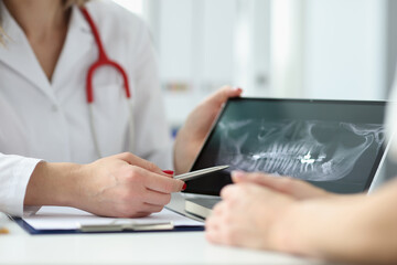 Fototapeta premium Dentist showing patient tablet with x-ray of teeth in clinic closeup