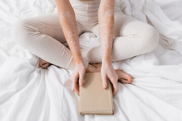 partial view of woman with vitiligo holding book in bedroom