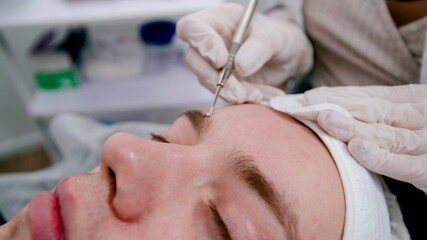 beautician makes procedures for cleansing the skin from acne