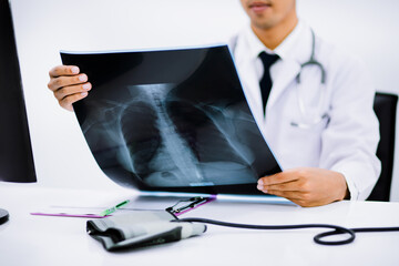 Fototapeta na wymiar Radiology doctor examining at chest x ray film of patient at health care clinic