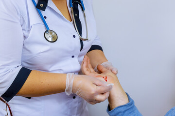 Hand injured patient visiting doctor traumatologist