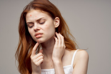 woman with loose hair pimples on face acne gesturing with hands Copy Space
