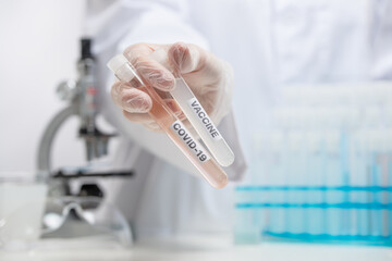 Macro shot view of microbiologist in protective gloves holds biological tubes with covid-19 vaccine on laboratory background. Backstage of scientific discovery. Healthcare and medicine concept.