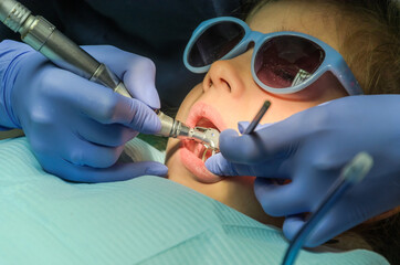 Children's dentist treats baby teeth	