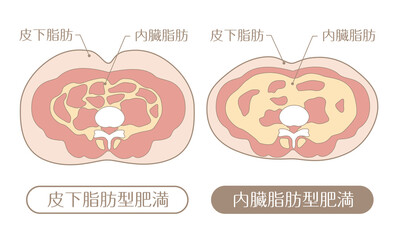肥満のタイプ　皮下脂肪と内臓脂肪（文字あり）