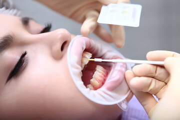 The dentist applies a protective gel to the teeth. Professional teeth cleaning. Hands in protective gloves. The concept of health. Prevention of caries.