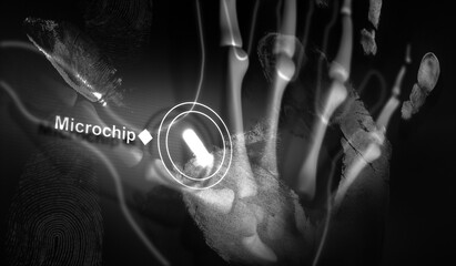 Microchip inside Hand