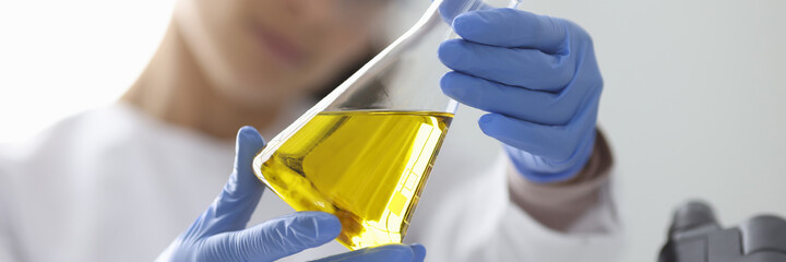 Female hands in rubber gloves holding flask with urine analysis in clinical laboratory closeup....