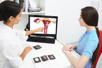 Gynecology, consultation. Gynecologist explains to a woman about a disease of the uterus, showing...
