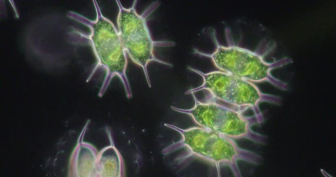 Protozoa and Green Algae in waste water under the microscope.
