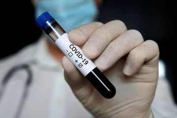 Test tube with covid-19 blood sample in male hand close up. Doctor in mask with positive coronavirus test