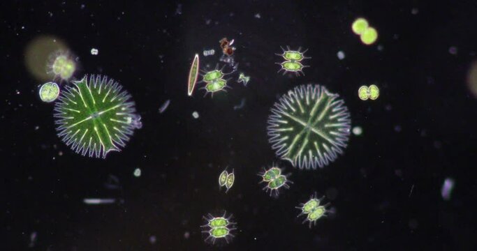 Protozoa and Green Algae in waste water under the microscope.
