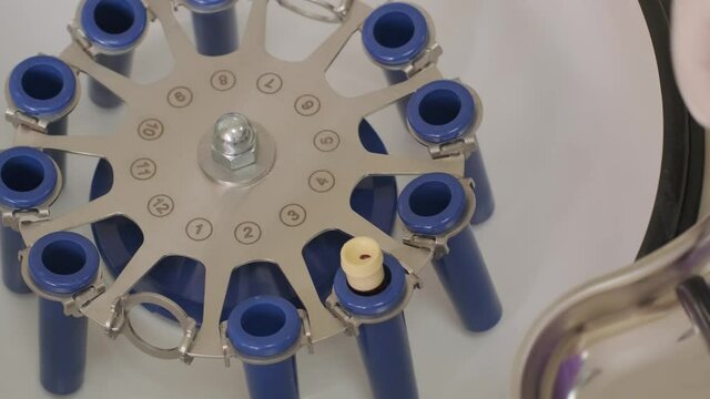 Platelet-Rich plasma preparation. Tube with blood in hands. Centrifuge. Background