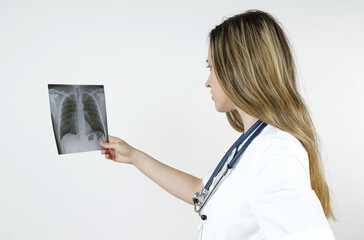Medicine and health concept. A young woman doctor examines an x-ray picture of human chest.