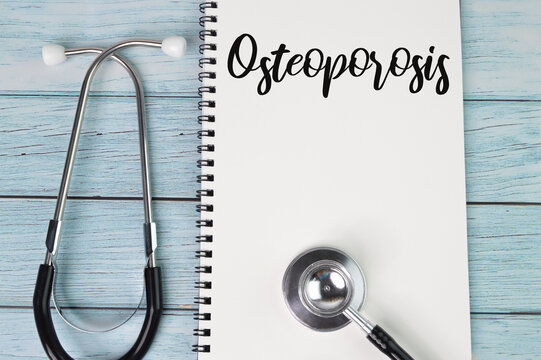 Top view of stethoscope and notebook written with text Osteoporosis over wooden background.. Health concept.