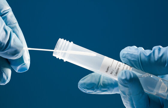 Transport of PCR virals in laboratory, transparent liquido orange closure, adhesive for patient, (obtaining analysis for results), in the hands of a doctor, with  blue background