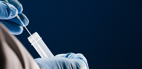 Transport of PCR virals in laboratory,  (obtaining analysis for results), in the hands of a doctor, with blue background - obrazy, fototapety, plakaty
