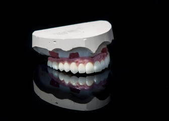 Ceramic teeth dental crowns model on black background.