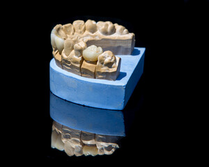 Ceramic teeth dental crowns model on black background.
