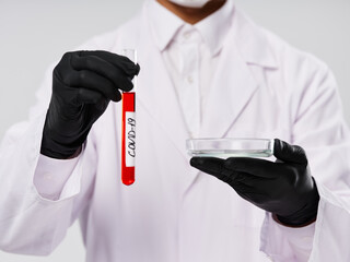 doctor in black gloves test tube with blood tests examination