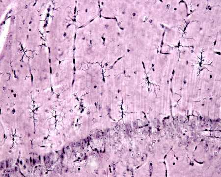 Microglia. Hippocampus