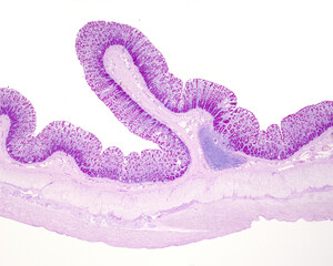 Wall of human colon. Goblet cells