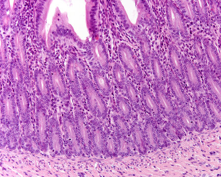 Small intestine. Mitosis
