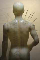 male acupuncture model with needles in the right shoulder