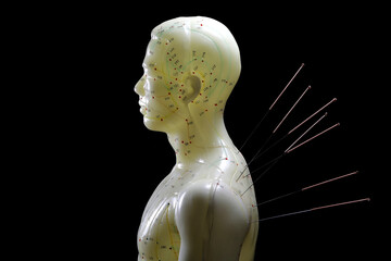 male acupuncture model with needles in the left shoulder against black background