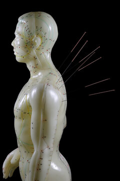 male acupuncture model with needles in the left shoulder against black background