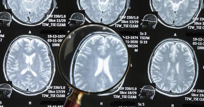 Mri brain scan background, magnetic resonance tomography. The doctor examines the patient's images under a magnifying glass.