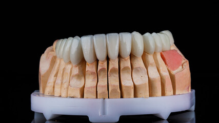 set of high quality ceramic veneers for the lower jaw on a black background