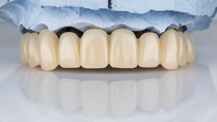 temporary dental prosthesis of the upper jaw on a light background © Dental Pro Content