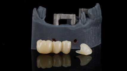 temporary dental crowns, models and bar on a black background