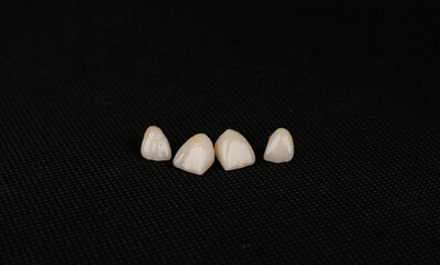 dental ceramic crowns, laminate veneers.
