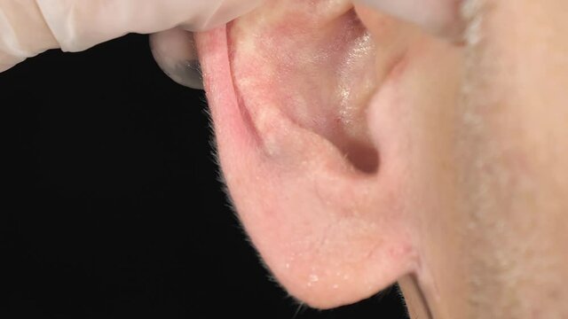 Checking on the ear after cleansing it with water