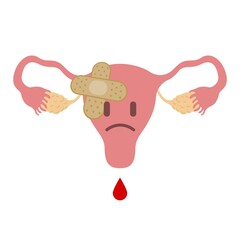 Sad uterus with adhesive plaster, pain during menstruation