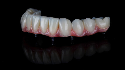 ceramic dental prosthesis with the gum of the lower jaw on a black background