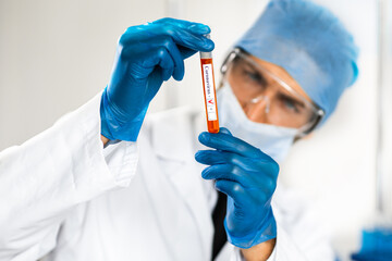 test tube in the hands of the researcher .