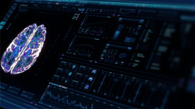 Perspective futuristic interface analyzing human brain anatomy and morphology. Medical profile of patient, brain lobes, neuron animation. Nerve impulses, EEG, electrical activity of the brain.