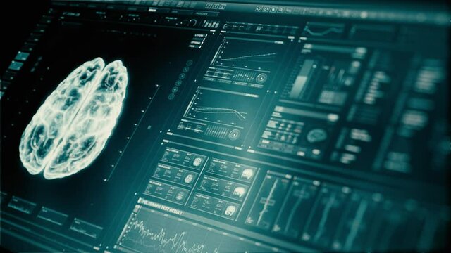 Perspective green futuristic interface analyzing human brain anatomy and morphology. Medical profile of patient, brain lobes, neuron animation. Nerve impulses, EEG, electrical activity of the brain.