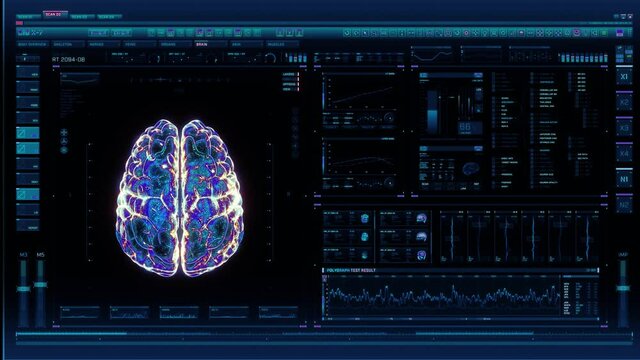 Holographic futuristic interface analyzing human brain anatomy and morphology. Medical profile of patient, brain lobes, neuron cell animation. Nerve impulses, EEG, electrical activity of the brain.