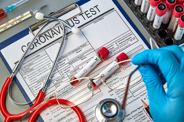 Two test tubes with blood samples for the COVID-19 test on the coronavirus test form. Blood test...